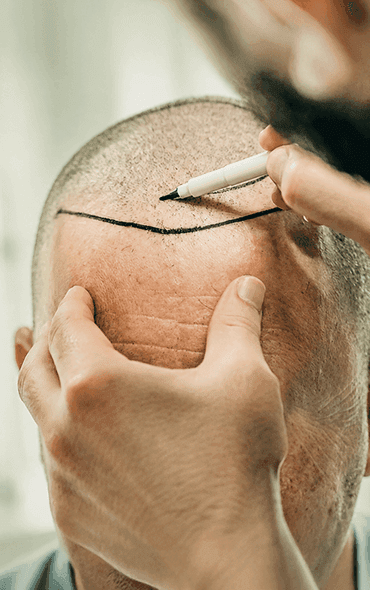 Creste Hair Restoration clinic